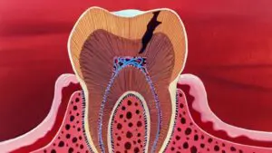 La Bouche et les Dents